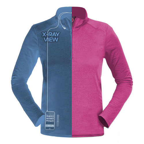 p2_qzipw-split_x_ray_3_2